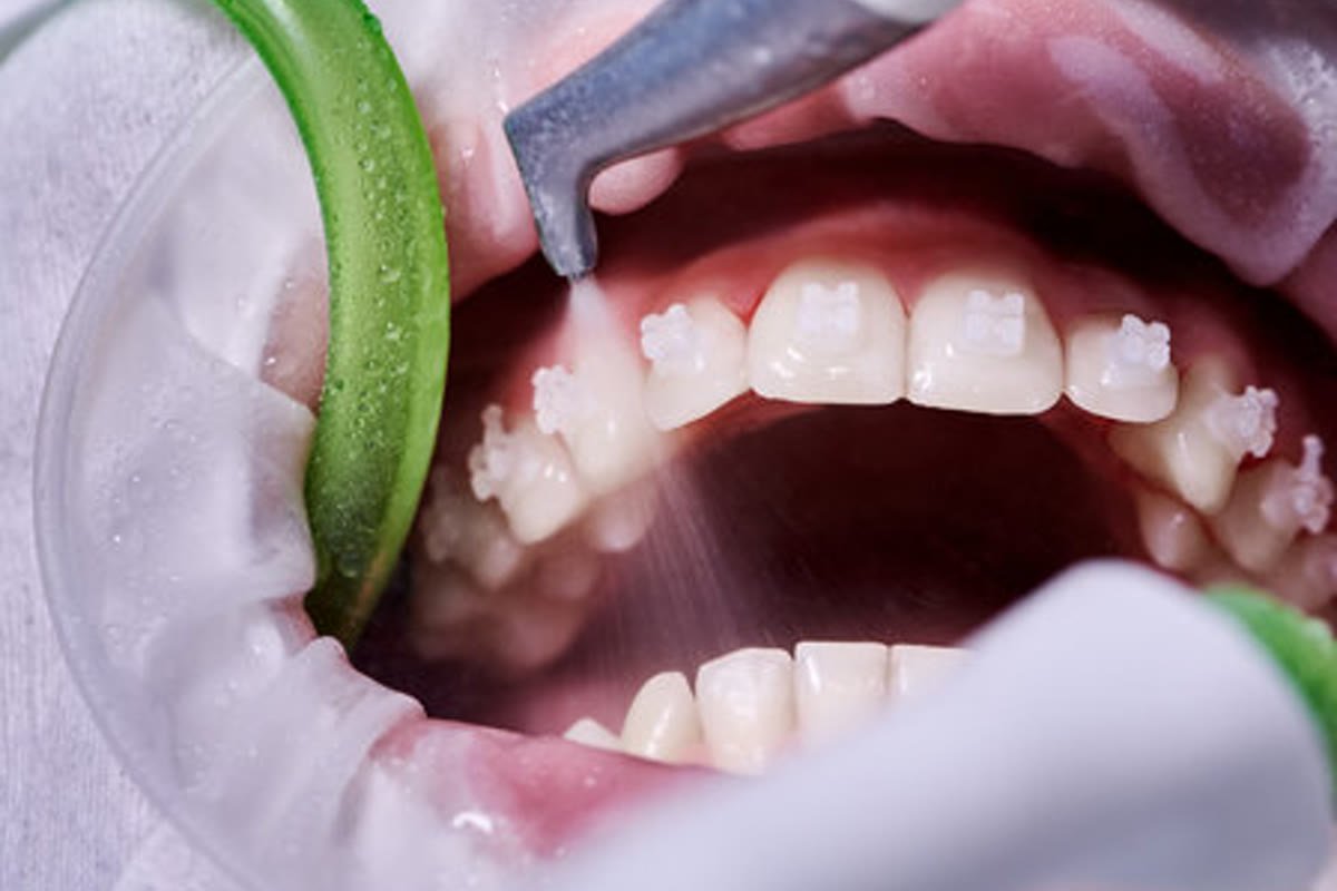 Dentist examining a patient's gums and teeth during a checkup