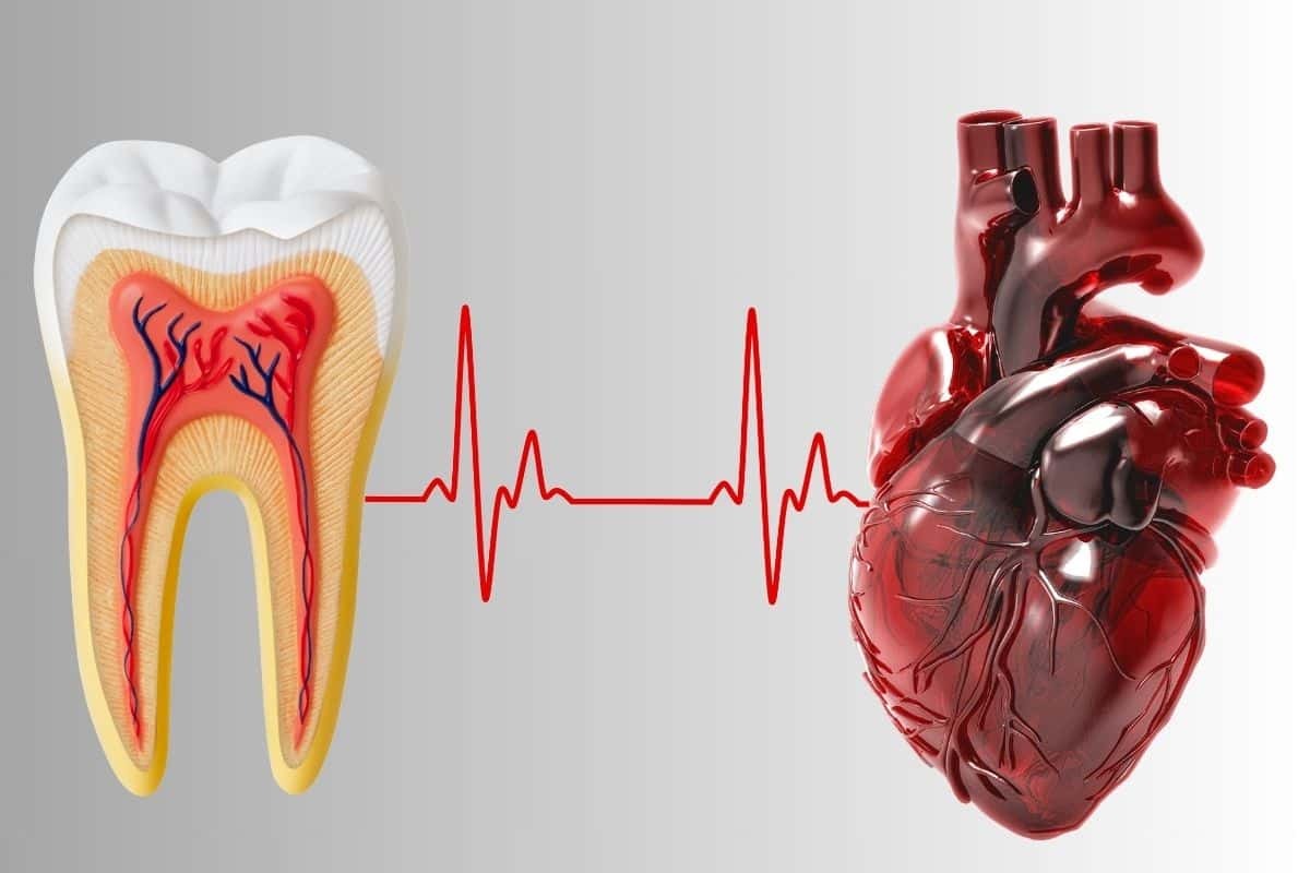 Oral Health Heart Diabetes Connection