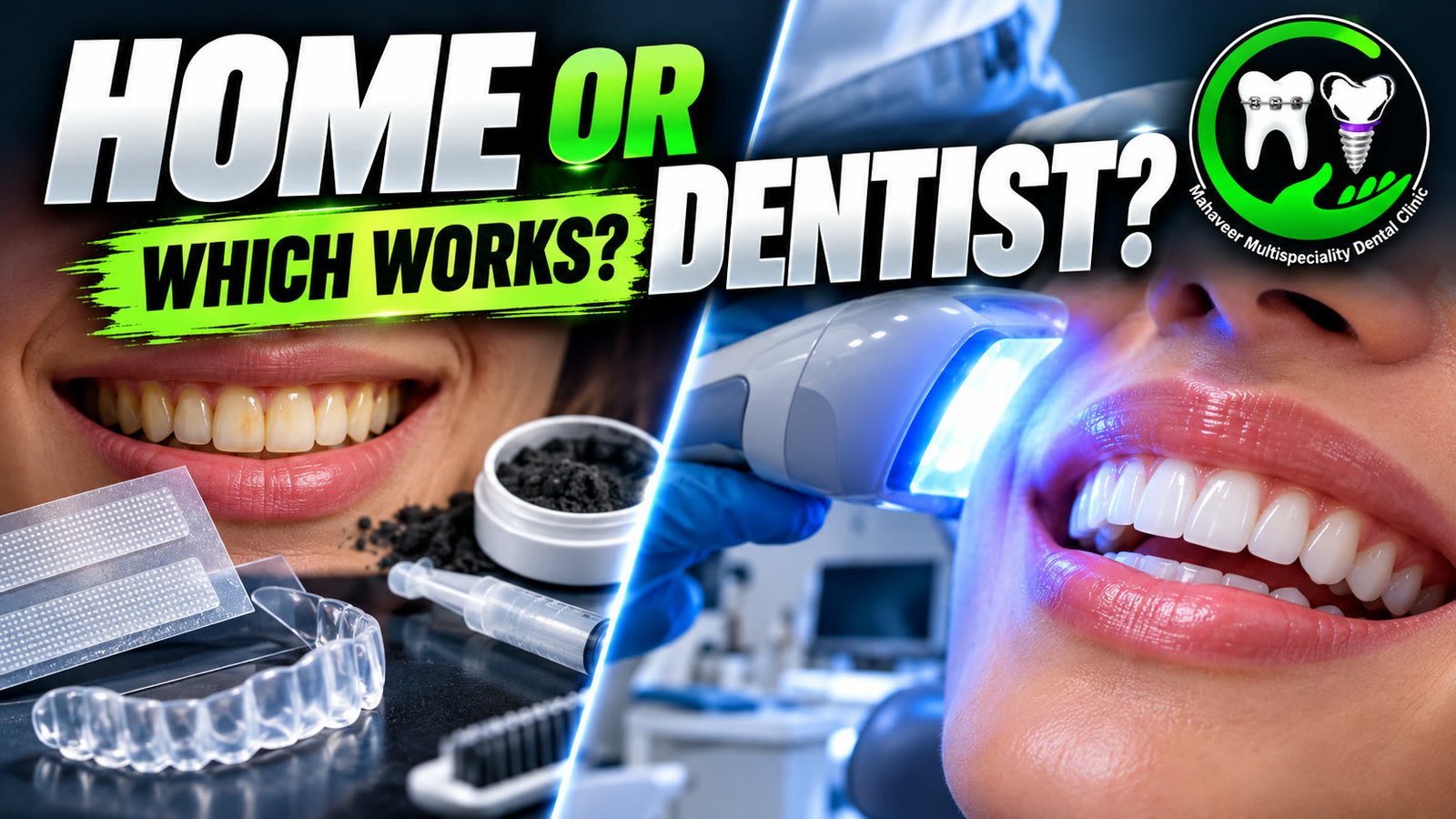 Comparison of at-home teeth whitening kit and professional dental whitening treatment