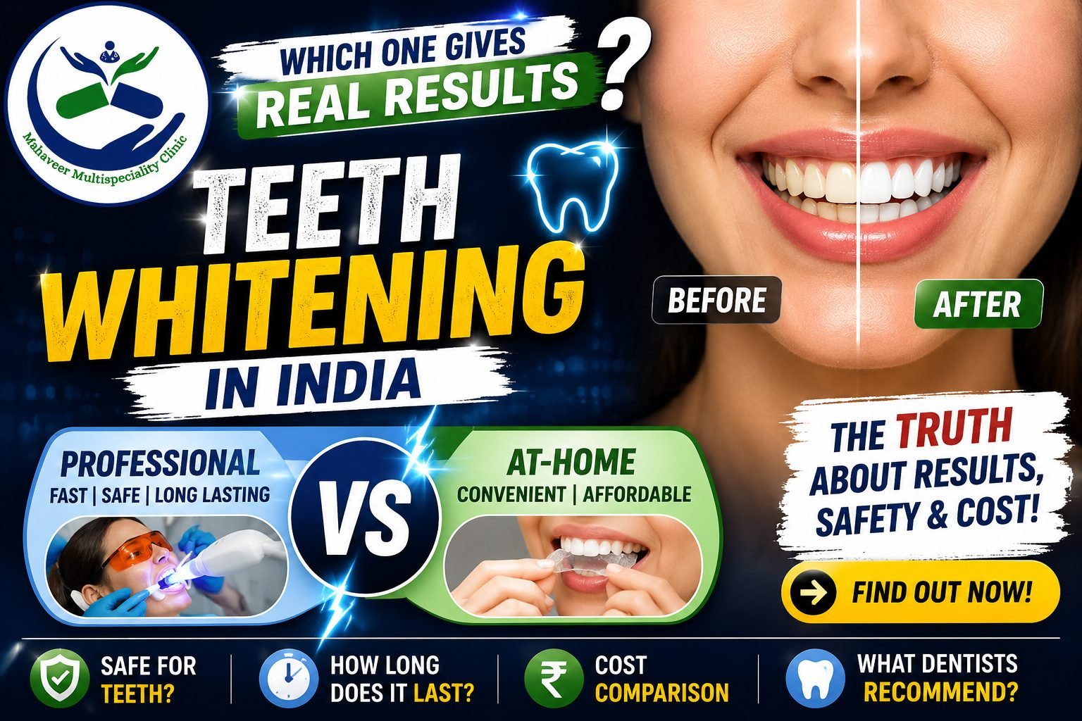 Professional teeth whitening vs at-home kits in India - the truth about results, safety and cost