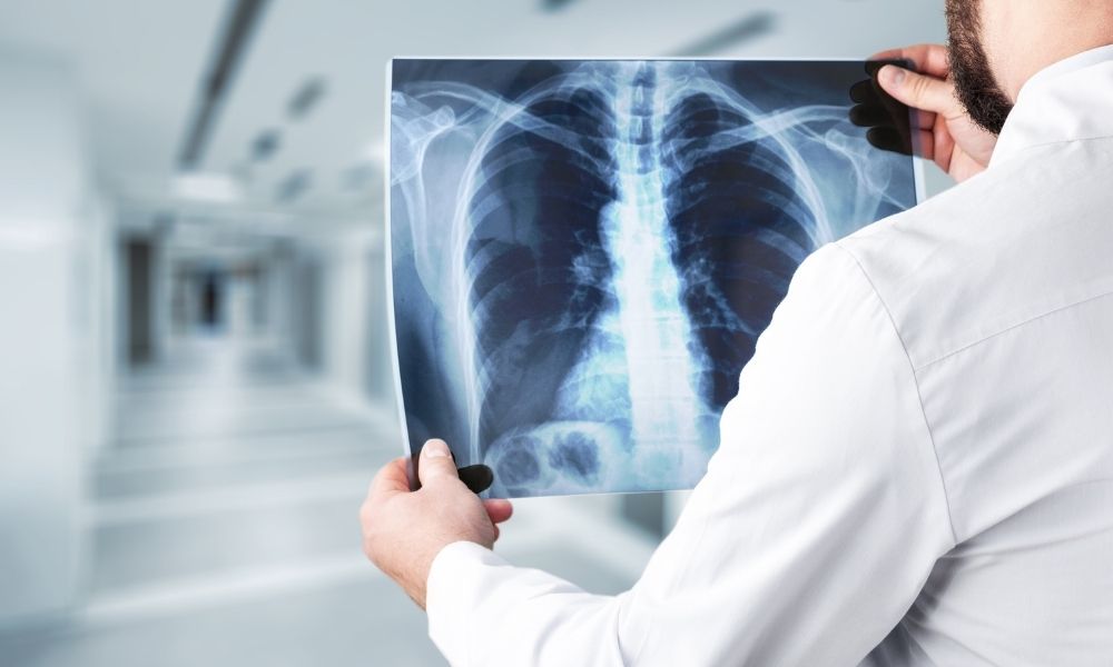 X-ray Imaging Services at Mahaveer Clinic